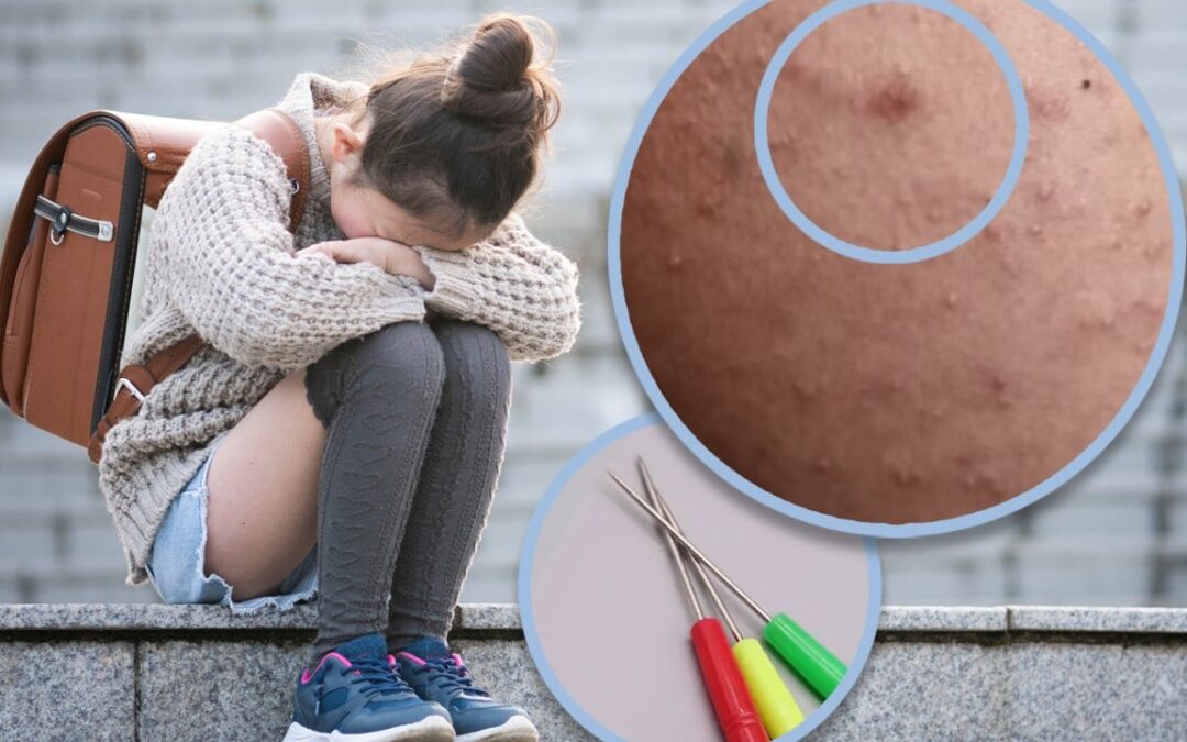 Outrage after China officials say schoolgirl stabbed 200 times with sewing awl ‘not bullying’