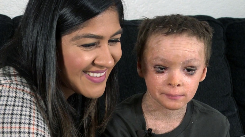 Nevada boy able to sleep with his eyes closed for the first time